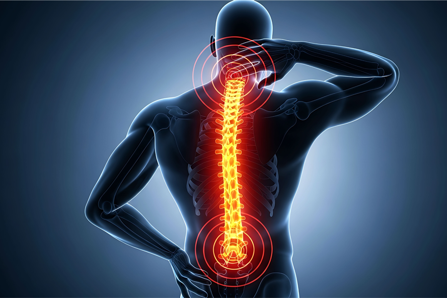 illustrazione 3d della colonna vertebrale con zone di dolore evidenziate in rosso a livello lombare e cervicale